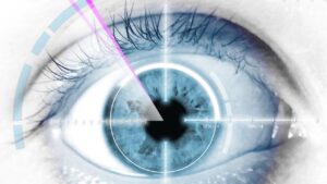 LASIK Surgery Age Limit 2025